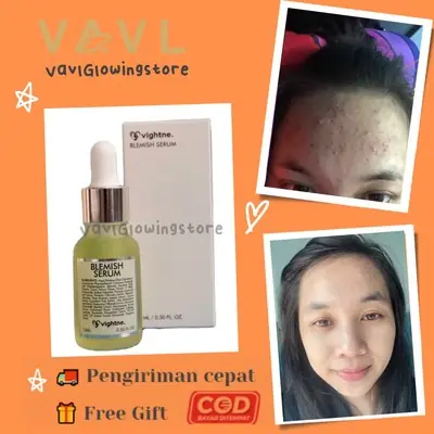 Vavl Beaute Beauty Water Basic Ori Blemish Serum by Vivalentine