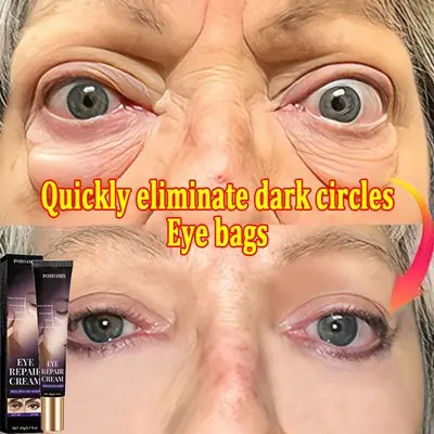 Eye Cream