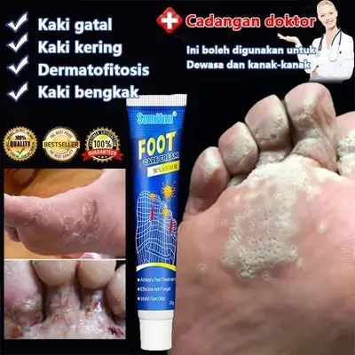 Ubat Gatal Kutu Air Crem Cap Kaki 3